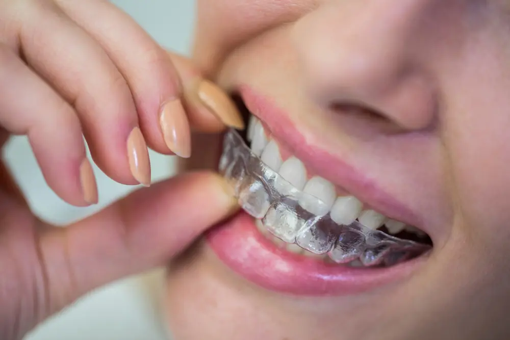 טיפול בשיניים בולטות